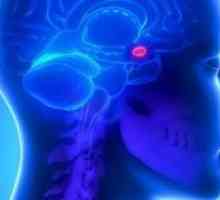 Adenom hipofize u mozgu: simptomi, liječenje i uklanjanje, prognoza, efekti, uzroci, simptomi