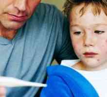Ste alergični na otrov ivy u djece, simptomi, uzroci, liječenje