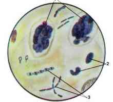Amylorrhea škrob u fecesu
