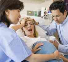 Amniotomija tijekom poroda