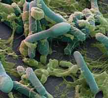 Anaerobne bakterije Vrste
