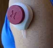 Test krvi bez bolova vakuum