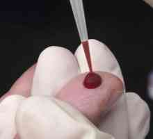 Analiza krvi pinworms (Enterobiasis)