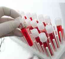 Krvni testovi za opistorhoz (IFA, Biokemija), antitijela (ATM)