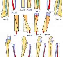 Anatomska struktura polumjera i lakatne jedinica