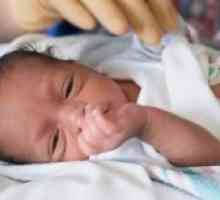 Anemija u novorođenčadi: uzroci, liječenje, opseg, posljedice, simptomi, znakovi