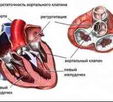 Aorte bolesti srca: liječenje, simptomi, znakovi, uzroci
