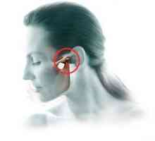 Artritis temporomandibularnog zgloba: liječenje, simptomi, dijagnoza