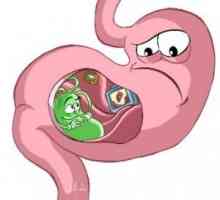 Atrofični gastritis: liječenje, simptomi, znakovi, uzroci