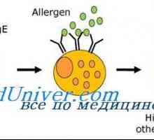 Razgovor (anamneza) za alergije u djeteta. Identifikacija alergen