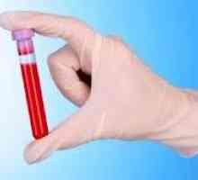 Krv biokemija gušterače s pankreatitisom