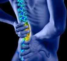 Bolovi u leđima: Uzroci, liječenje