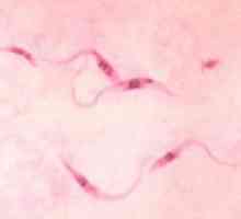 Chagas bolest: simptomi, tretman, uzroci, dijagnoza, uzroci
