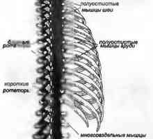 Bol u leđima uzrokovana dubokim paraspinalnih mišića