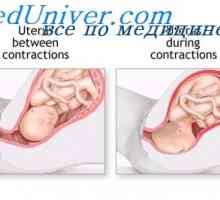 Trbušni mišići tijekom porođaja. aktivnost maternice