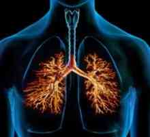 Bronha u plućima: liječenje, simptomi, dijagnoza, uzroci, simptomi