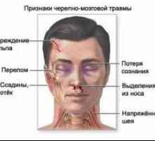 Traumatska ozljeda mozga: prva pomoć, liječenje, posljedice, simptomi, znakovi, uzroci