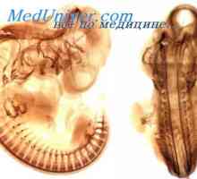Fetalni kranijalni živci. Razvoj kranijalni živci embrija