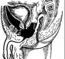 Cimptomy i dijagnostika povrezhdeniq zdjelicu i prsni organi. kontrast radiografija