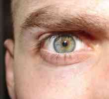 CMV retinitis: simptoma, liječenje, dijagnozu, prevenciju