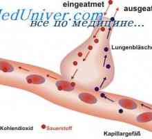 Dijagnoza sulfatidoza. Sfingomielinoz Niemann-Pickove bolesti