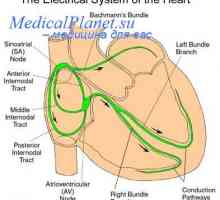 Distribucija srčane kontrakcije. srce elektrostimulator