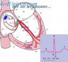 Odstupanje osi. Vektor analiza ventrikularne hipertrofije