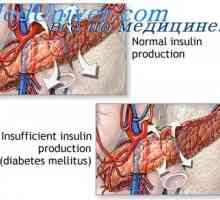 Učinak inzulina na metabolizam ugljikohidrata. Razmjena glukoze inzulina