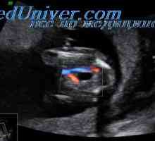 Točnost Doppler fetalni srca. Doppleroehograficheskie performanse srce fetusa