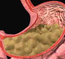 Fibrinozan gastritisa