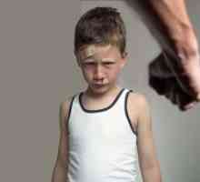 Fizičko zlostavljanje djece