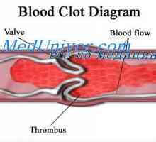 Formiranje fetusa arterije. Razvoj kruga Willis arterijskog kruga