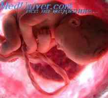 Formiranje mišića udova u fetusa. Razvoj embrija u mišićima vrata