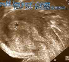 Funkcionalna promjene pod utjecajem ultrazvuka. Fetalni anomalija pod Uzi