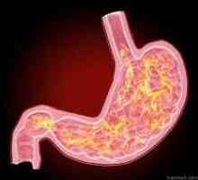 Gastritis s niskim kiselosti