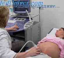 Hijalinomembranska pluća. trauma rođenja i fetalni oštećenja živaca