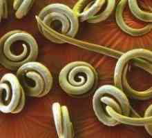 Infestacija parazitom s pinworms Liječenje simptomi