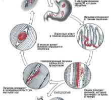 Helminta (crvi) koji žive u ljudskim mišićima, simptome i fotografija