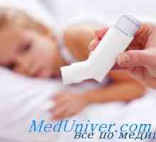 Glukokortikoidi (prednizolon) za dječje astme. Teofilin u liječenju astme