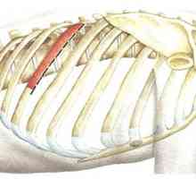 Kirurški pristupi torakalne kralježnice