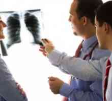 Kronična intersticijske pneumonije i plućna fibroza, liječenje, simptoma, uzroci