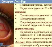 Imunodeficijencije ataxia telangiectasia-. Louis-Bar sindrom