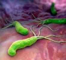 Infekcija Helicobacter pylori: liječenje, simptomi, uzroci, dijagnoza, simptomi