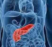 Zaražene nekroze pankreasa
