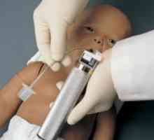 Neonatalna intubacija: cijevi Tehnologija intubacija
