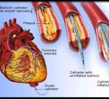 Studija arterije