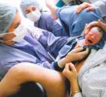 Protjerivanje fetus