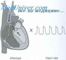 Povećanje srčanog outputa. hipertrofija miokarda
