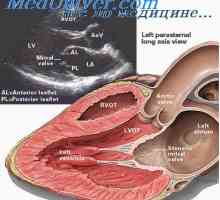 Hemodinamski poremećaji u srčanih mana, a fizički napor