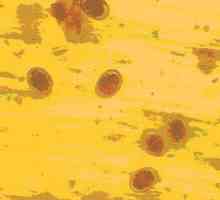 Roundworm jaja u ljudskim izmetom (foto) kao što izgleda, način prijenosa Ascariasis odrasle i djecu